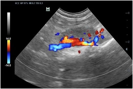 丝瓜|乳腺的“保护伞”出现,不是婆婆丁、丝瓜,坚持每天吃,乳腺会感谢你