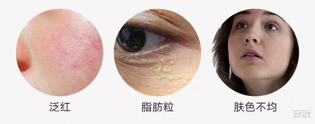 护肤品 因包装丑被“打入冷宫”的护肤品,在日本卖出“天价”,资生堂地位不保