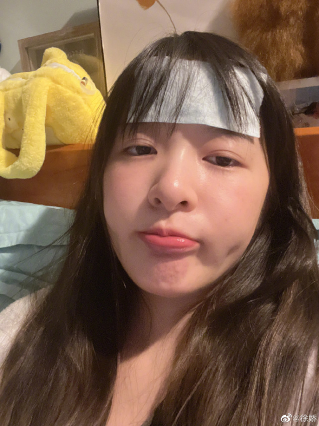 徐娇|徐娇自曝确诊“炫饭株”:一天吃5顿仍被饿醒,焦虑导致失眠