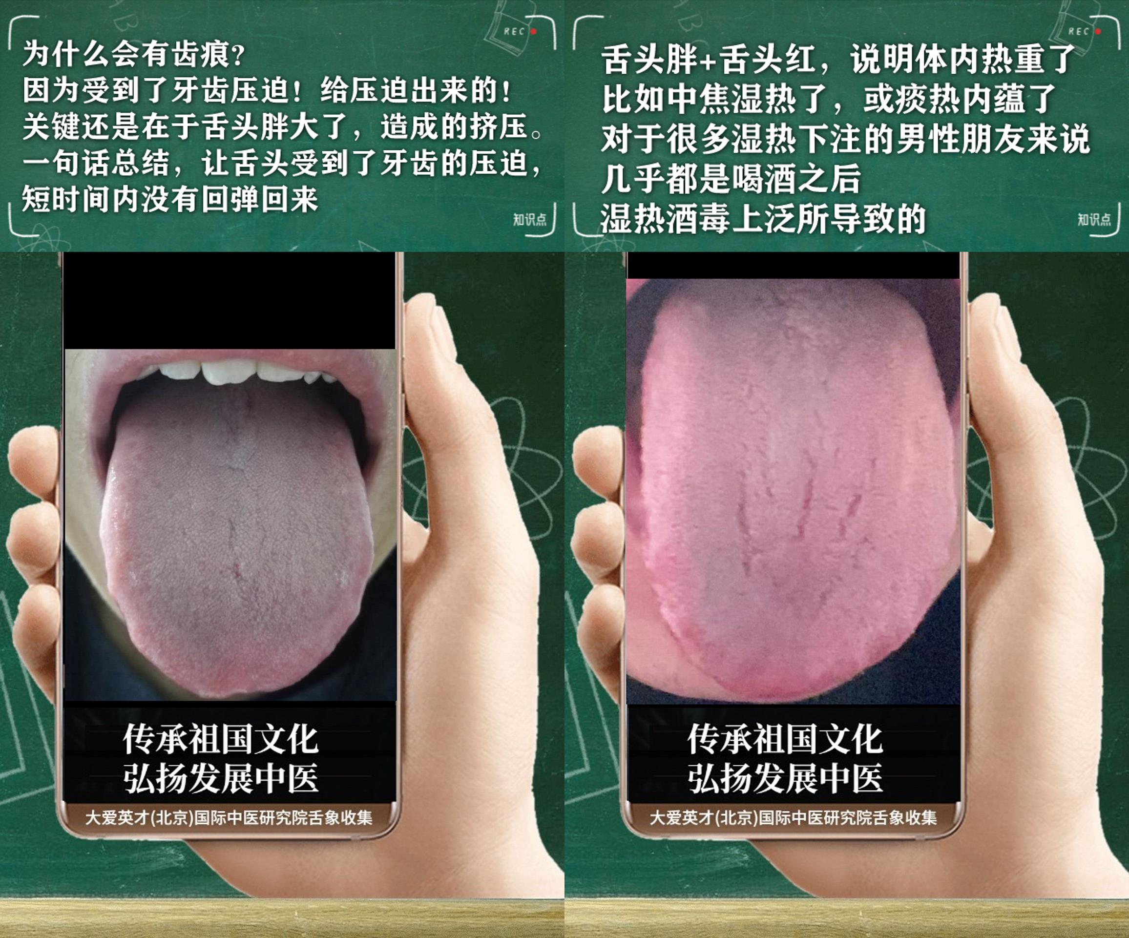 穴位|中医分析:很烦躁,腰膝酸软,鼻子不通,一直反复很烦躁