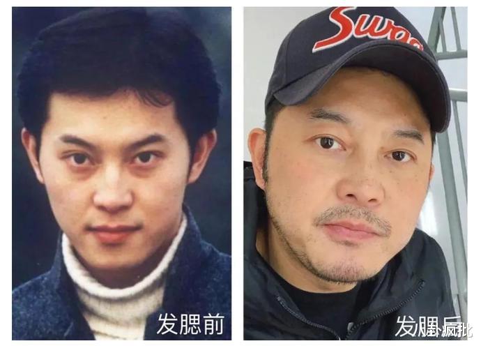 鹿晗|发腮堪比“毁容”!16位因发腮颜值暴跌的明星