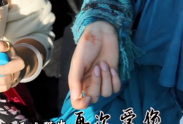 片场|明星的片场真实模样：鞠婧祎膝盖破皮坐轮椅，唐国强被爆料不记词