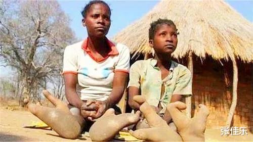 难道鸟族人真的存在，一群长着两个脚趾头的人，跟鸵鸟一样