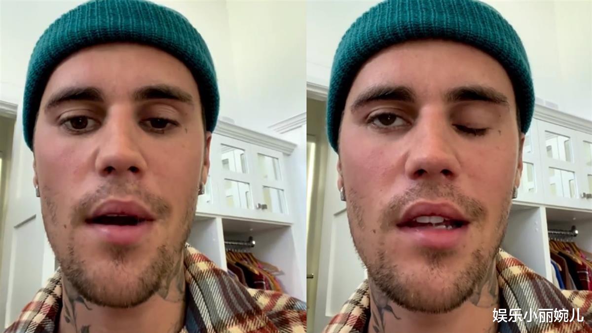 张若昀|贾斯汀·比伯罹患罕见神经性疾病，右脸瘫痪，取消演唱会