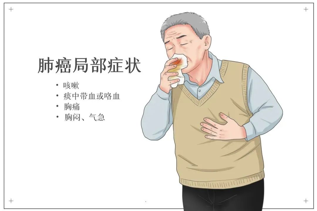 米粉|国际肺癌日 | 防治肺癌,这些知识一定要知道~