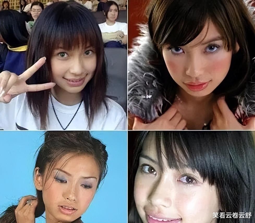 整容|有种倔强叫“我没整容”！明明从大饼脸变成了V脸，当观众瞎吗？