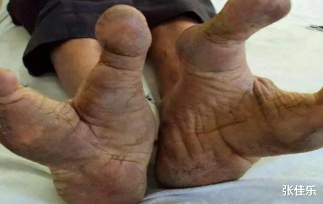 难道鸟族人真的存在，一群长着两个脚趾头的人，跟鸵鸟一样