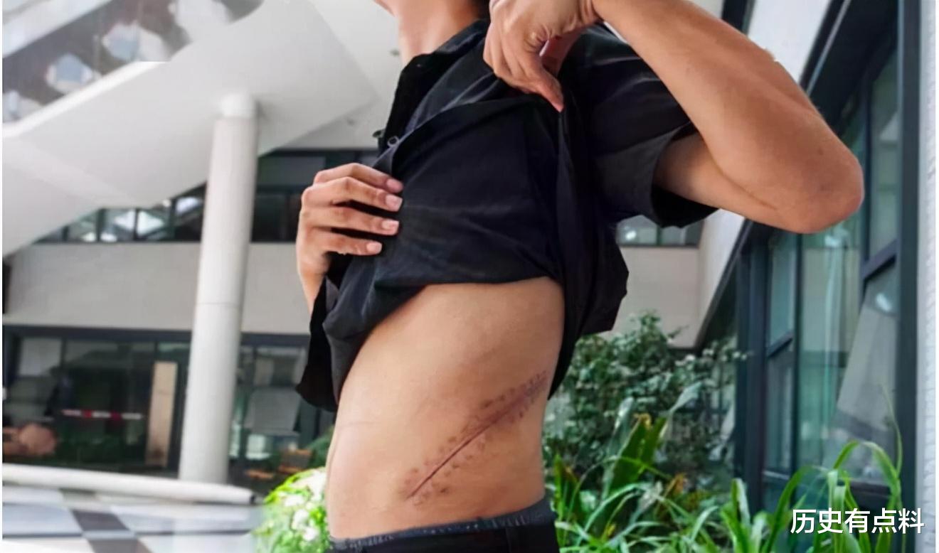 苹果|11年前,高中生卖肾买苹果手机,获赔147万,生活却过得十分悲惨