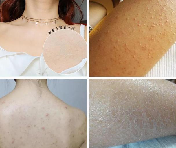 女生涂身体乳和不涂身体乳,“差别”也太大了,很多人都还不知道