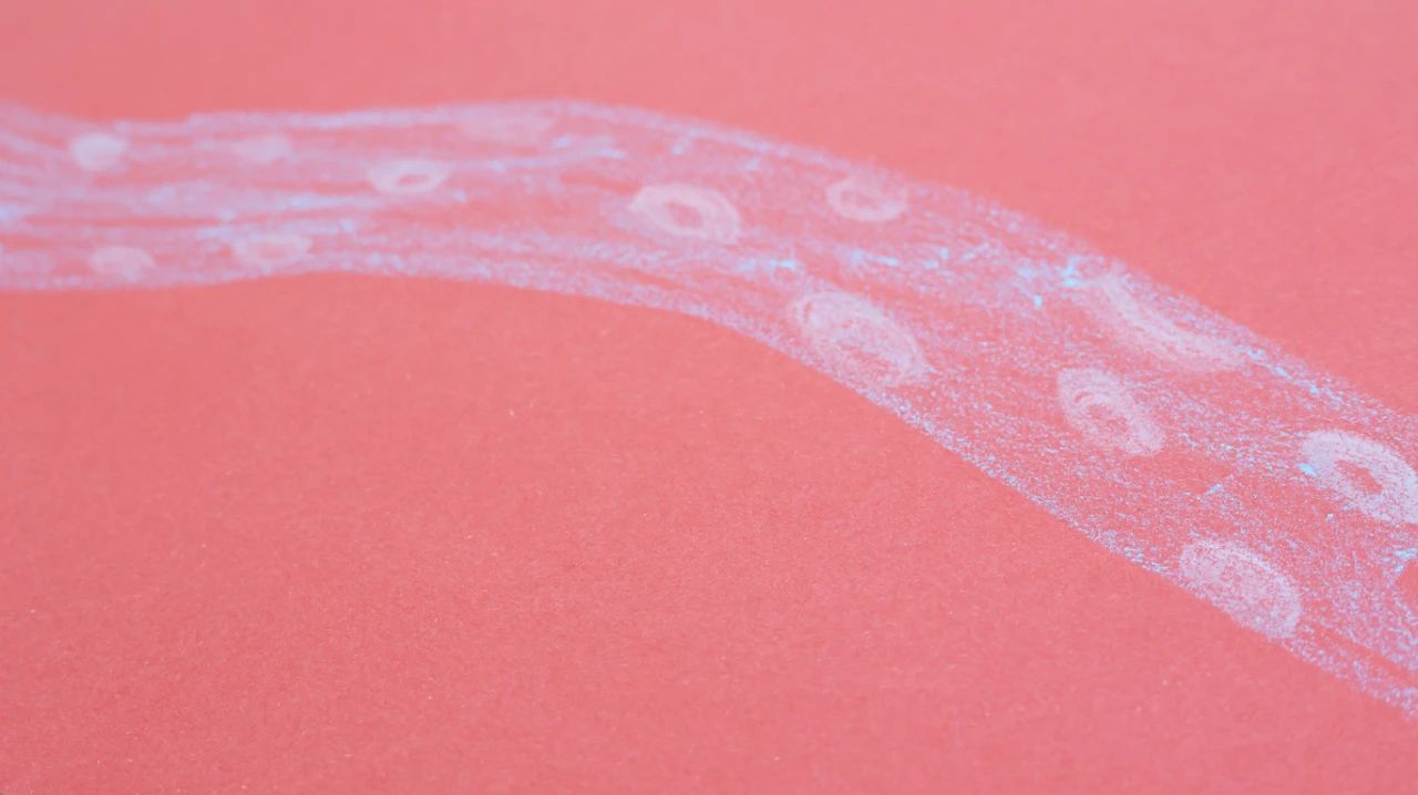 牙齿|什么是心肌缺血?医生:3种心肌缺血以及常见的引发因素了解一下