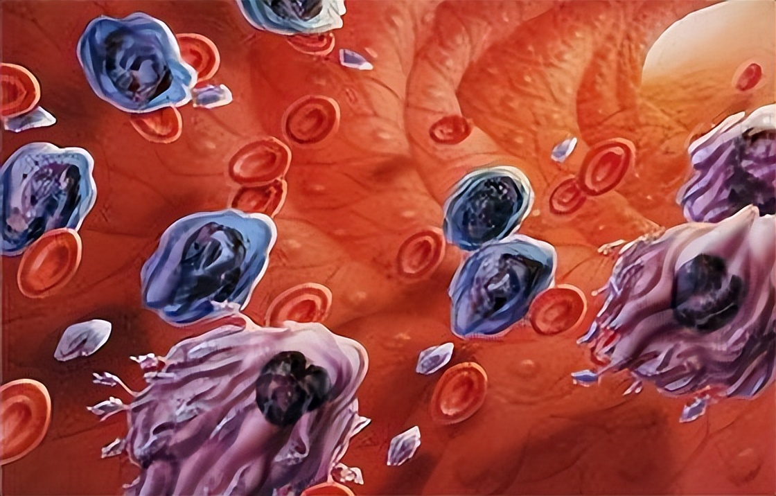 中成药|血热则痒,血湿则胖,血虚则淡…分享3个中成药,养血补血