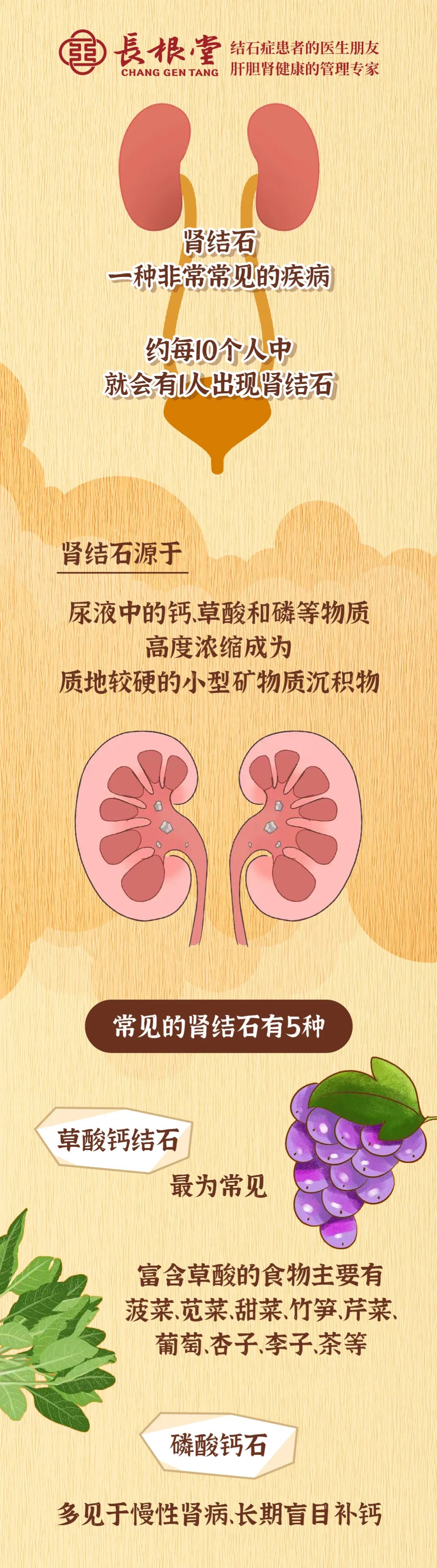 饮食健康|小结石,大危害|一图看懂肾结石的“来龙去脉”