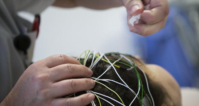 癫痫病|女子头痛怀疑癫痫，直到按摩时闻到臭味，才发现她脑袋长了个瘤