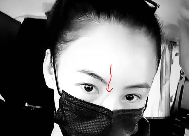 柯达|张柏芝晒出怼脸自拍，自曝鼻梁被3岁小儿子抓伤，超长伤疤很明显