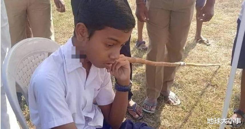 超命大!印度14岁少年遭「标枪刺穿脖子」,淡定坐等救护车送医