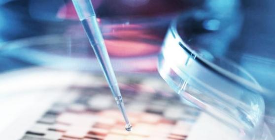 艾尔登法环|贝索斯2.7亿砸基因科技，乔布斯多活8年，富豪都追捧基因检测？