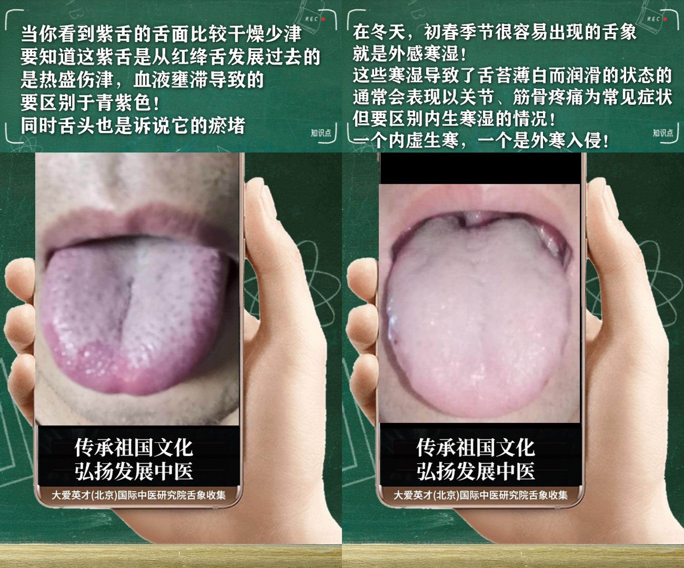 萎缩性胃炎|中医分析:心烦气短,胸闷、咳嗽,好好坏坏非常崩溃