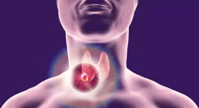 疾病|体内有“结节”的人，尽量少吃5种“发物”，忍住不吃或有帮助