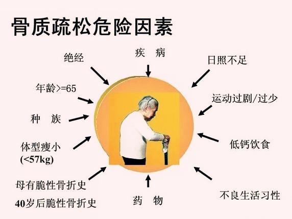 胰腺炎|68岁老人常吃“1物”,骨密度从0.8到了3.5,腿不疼、骨质疏松改善