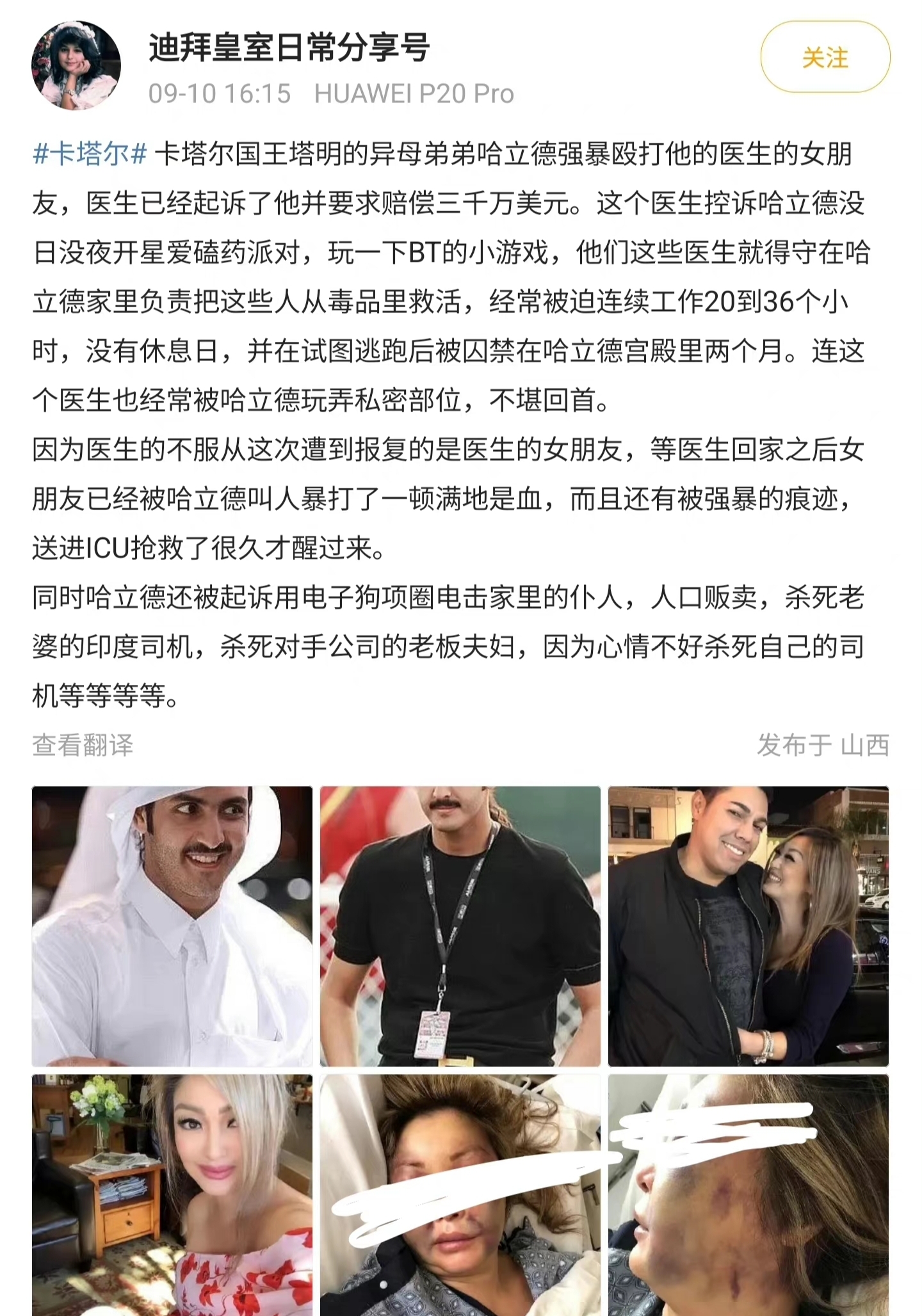 刘诗诗|金晨模仿卡塔尔王子翻车,裹白头巾装中东富豪,被网友吐槽无底线