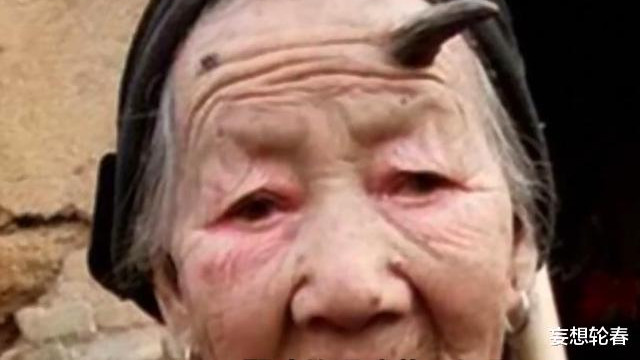 基因突变！10位地球上百万分之一的罕见人类！