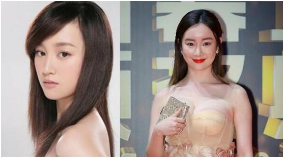 整容|7位被整容毁了的明星,有人美丽尽失事业滑坡,有人甚至赔了性命