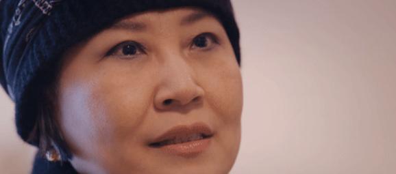 张蔷|做过眼袋手术的明星：张蔷直言后悔，闫学晶自曝割眼袋和双眼皮