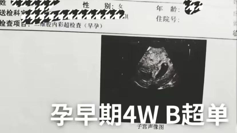 朱之文|儿媳陈萌怀上双胞胎，大衣哥奖励88万，网友却喊话先去做亲子鉴定