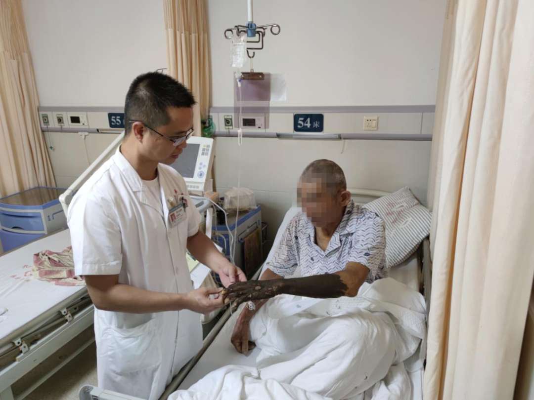 银环蛇的毒性究竟有多毒?被咬伤后会嗜睡但不会无痛苦地一命呜呼