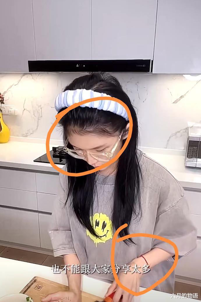 马思纯|蔡卓宜疑似植发，比鞠婧祎的自然，手上戴红绳或跟王大陆有关