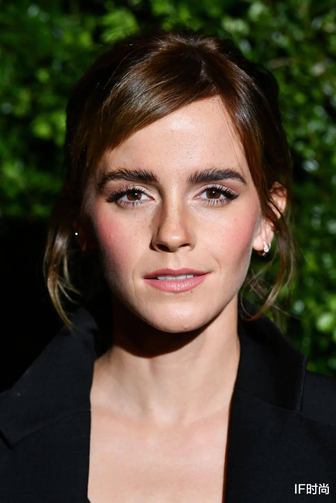 明星整容|没了《哈利波特》的魔法，32 岁的她已经老了？