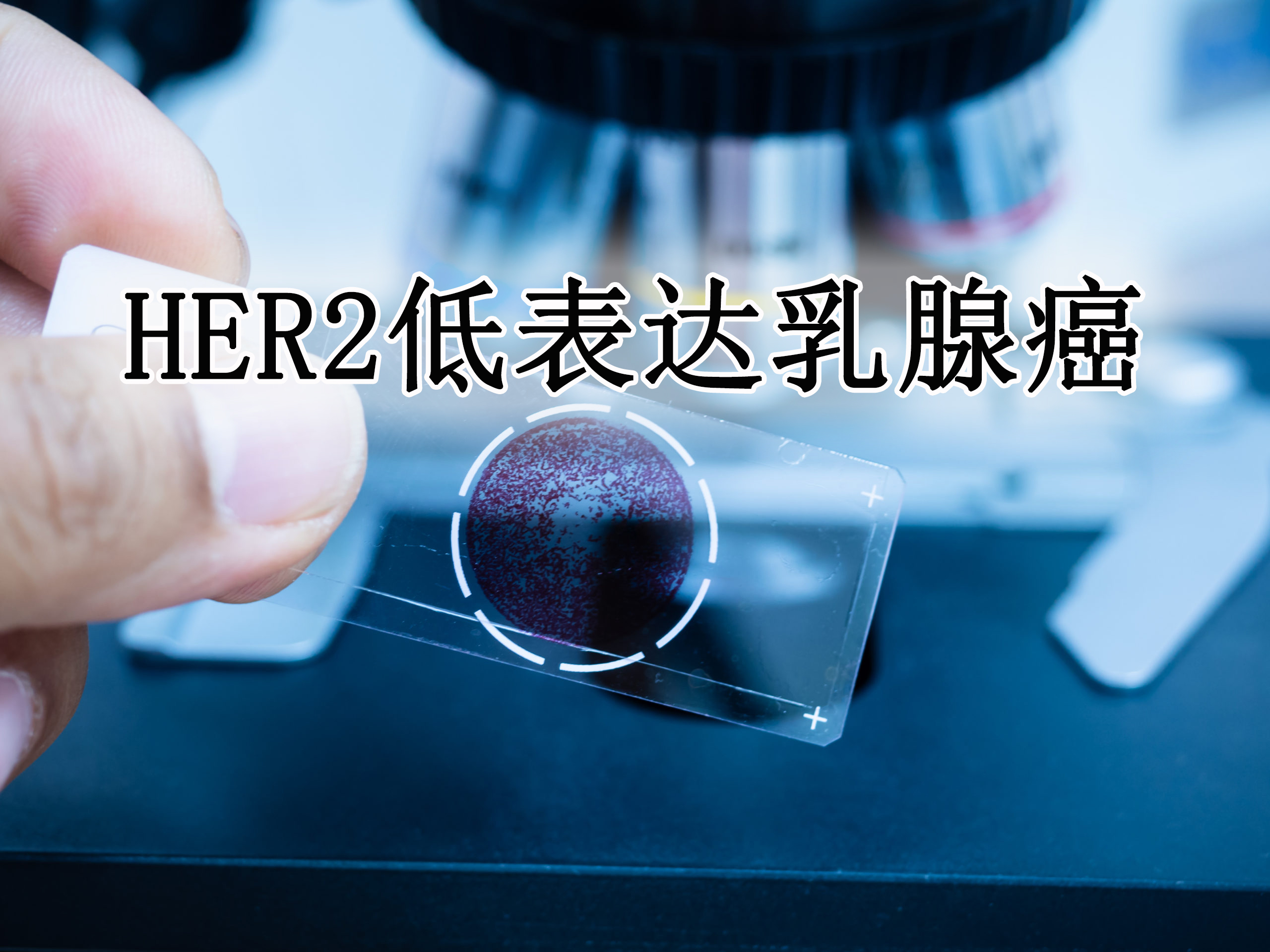 |总生存期提高6个月以上！HER2低表达乳腺癌首个靶向药Enhertu获批