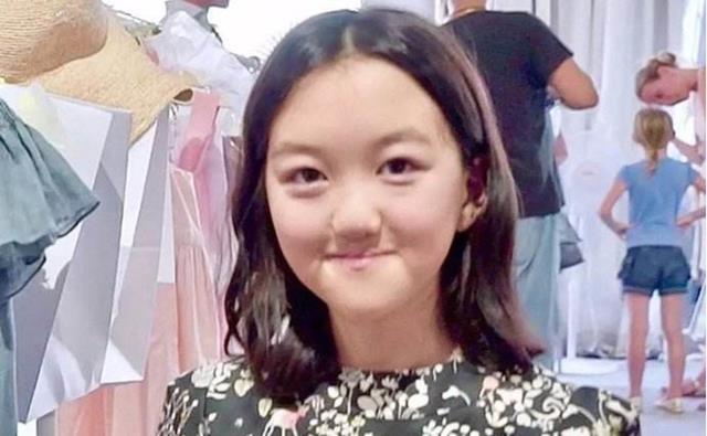 小姐姐|15岁李嫣现身唇腭裂医院，兔唇治好后颜值回归，已是医院的活招牌