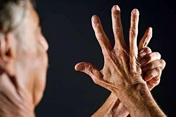 尿酸|体内尿酸升高,身体可能会亮3处“红灯”,须小心肾衰竭!