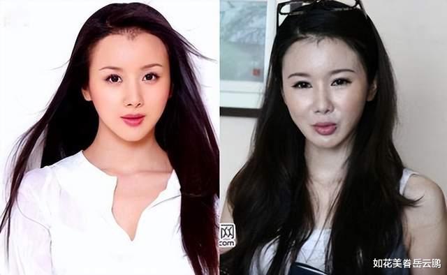 古天乐|古天乐竟不是原装脸,原来男神在脸上动过刀,跟成龙一样