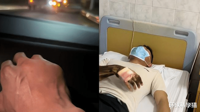 比五步蛇毒!男子被竹叶青咬伤:打完5小时点滴后,才感觉活过来