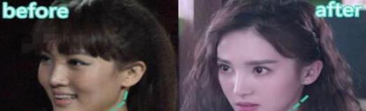 杨幂|从“大饼脸变成小V脸”的9位明星，杨幂说整了牙，金晨死鸭子嘴硬