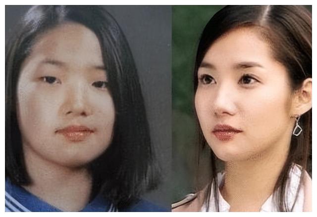 因整容走上颜值巅峰，没有出现过后遗症，如今美成整容模板
