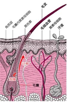 痛风|发根变白要当心！可能是毛囊型白癜风出现的信号