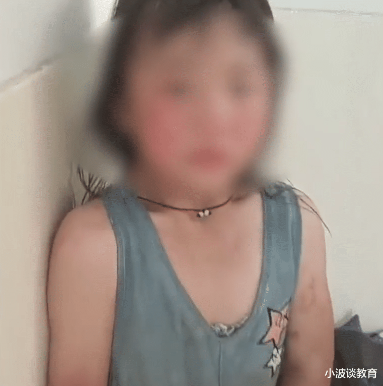 小女孩被后妈殴打，打得遍体鳞伤，跑到邻居家躲避，更多细节曝光