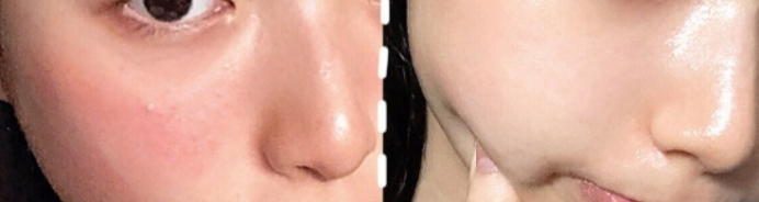 运动 烂脸逆袭少女肌  ？这些孕妇水乳妇产科医生都在用，孕妈：赶紧囤