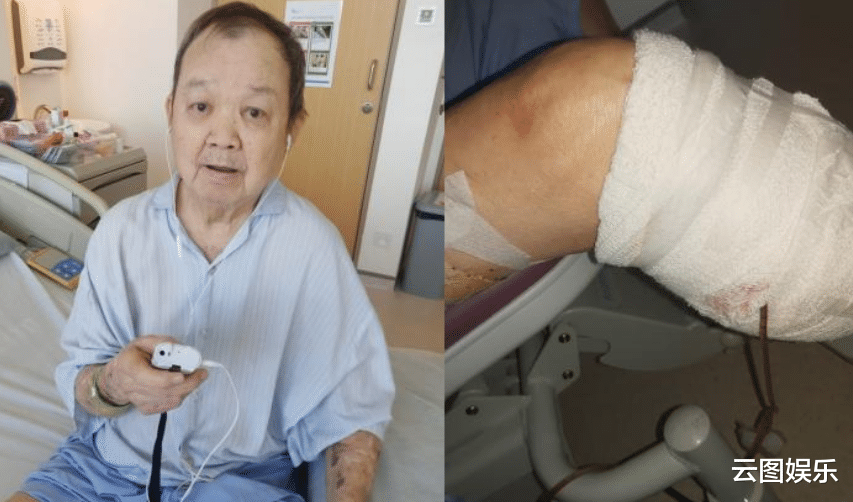 医生|84岁老戏骨唐琥截肢后靠轮椅代步，称比死还痛苦，感觉在连累家人