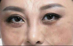 肝脏|不想给自己的肝找罪受，晚餐尽量别碰5类食物