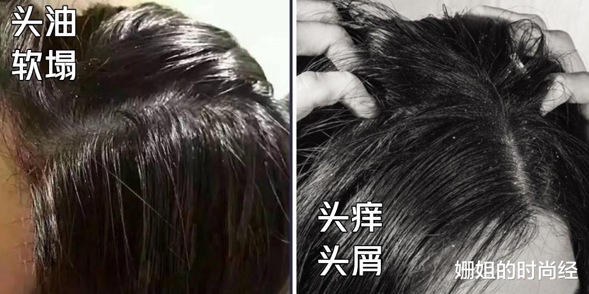 面霜 洗发水“白名单”：满婷适合夏季，舒蕾也不错，百雀羚好用还便宜