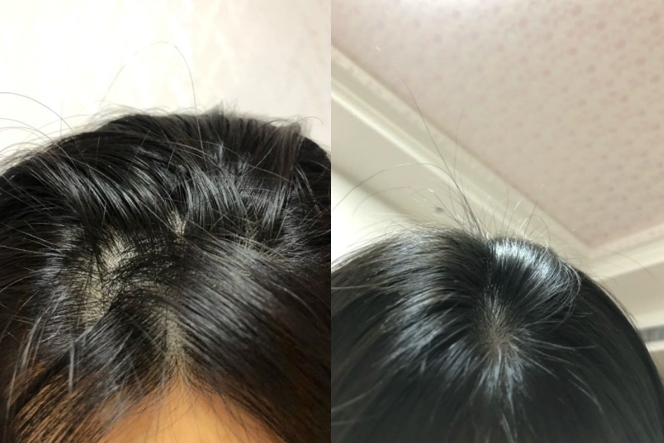 油头、头屑找到解药啦！5款“神仙级”孕妇洗发水，闭眼入不被坑