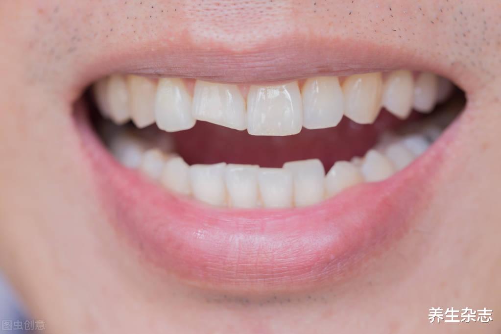 老中医揭秘:两个小方法,养牙护齿,70多岁还牙齿坚固,精力旺盛