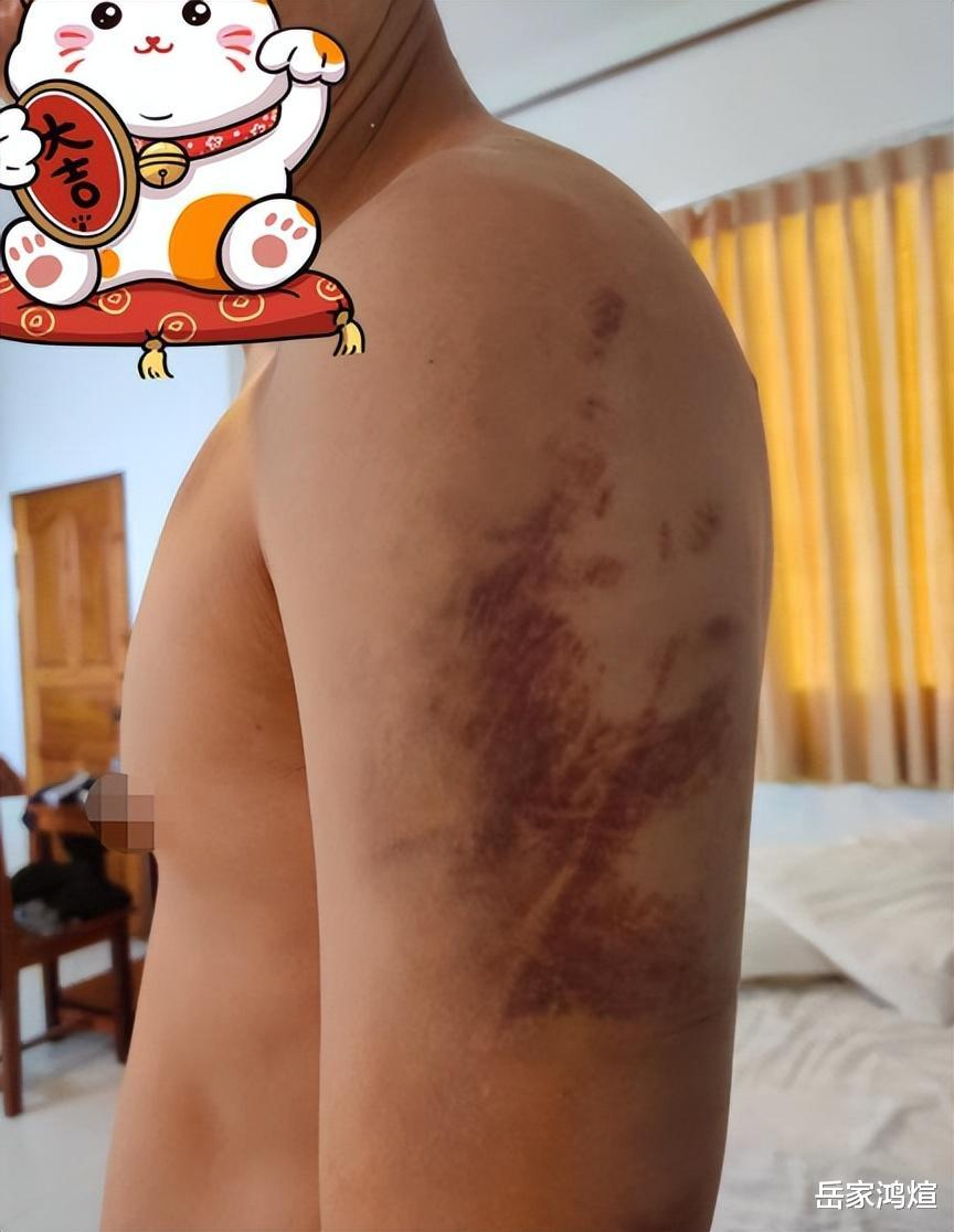 缅甸|中国男子被卖缅北,目睹身边人遭电击割舌,挖洞出逃跨越三国回家