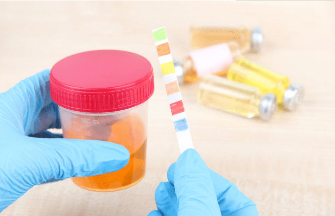 尿蛋白|“肾病刺客”尿蛋白频繁出没,记住这7点,可有效消除预防肾衰