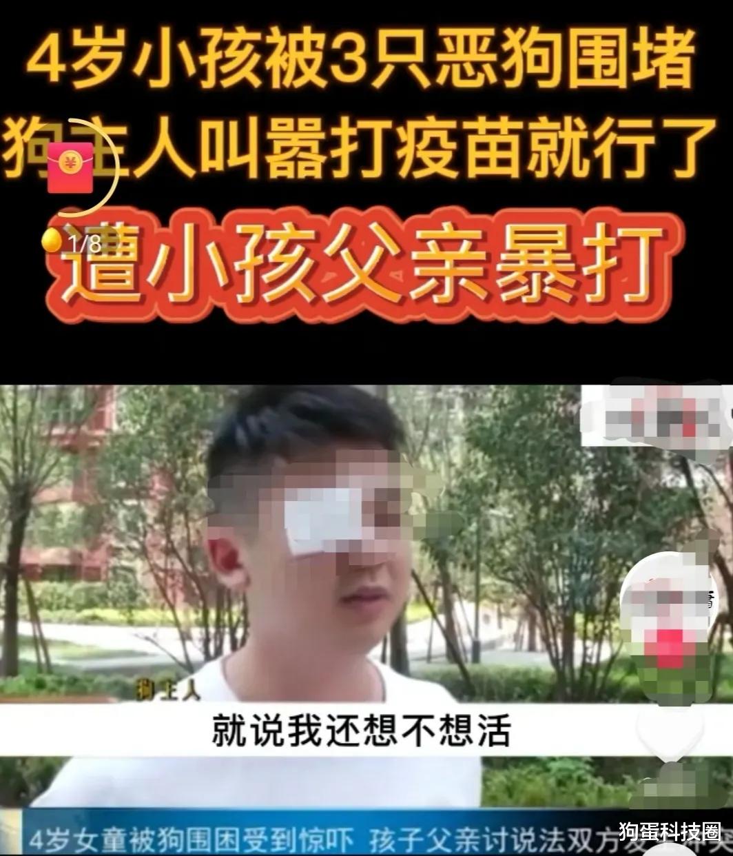男子遛3条无证狗咬伤4岁儿童,态度嚣张被孩子爸爸暴打,声称追究打人者
