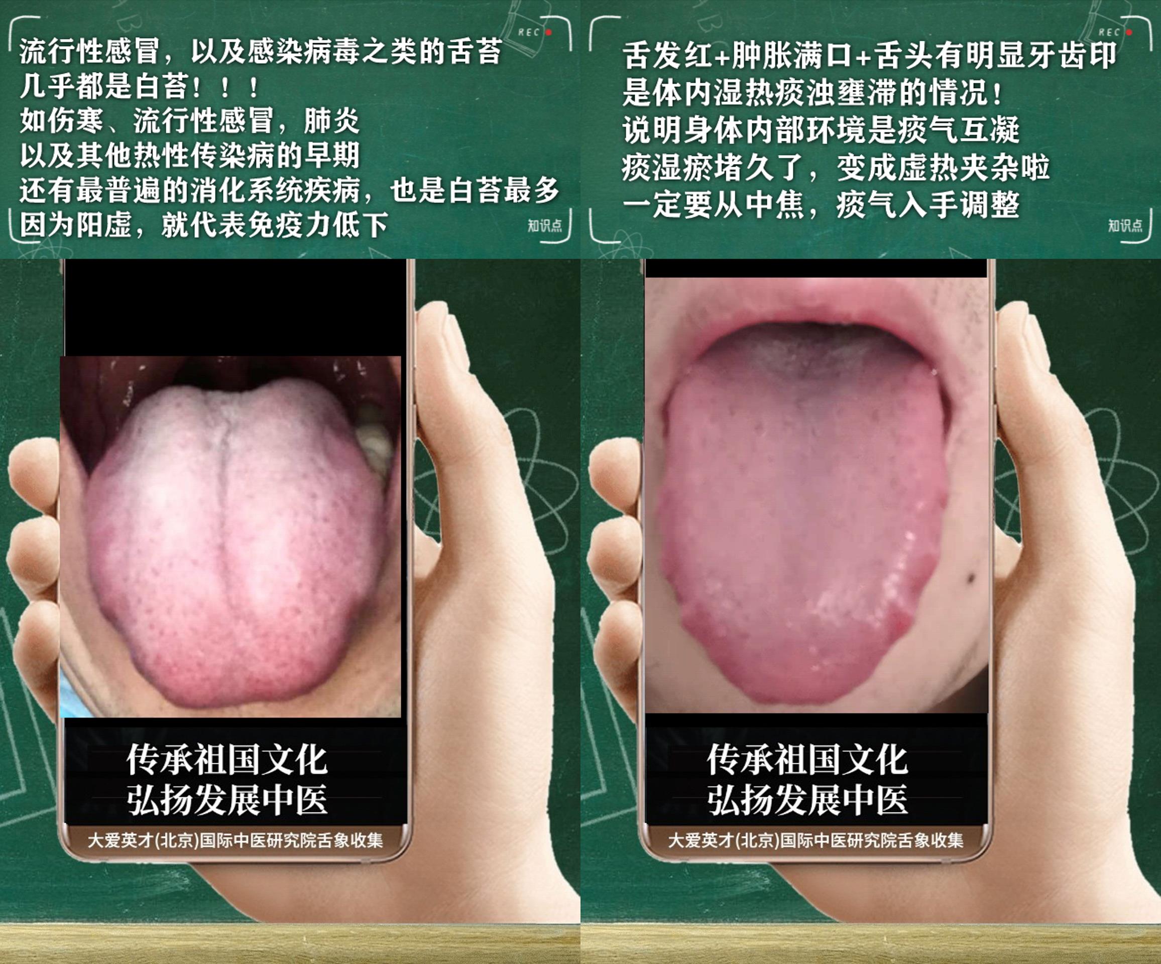胃病|中医实解:满脸油腻,鼻炎,小便量少,手脚发冷